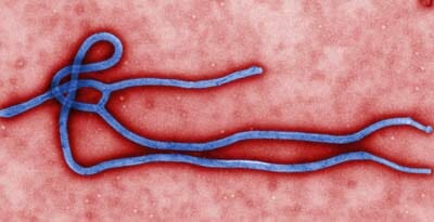 ebola_strain_for_blog.jpg